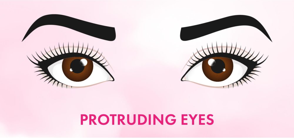 protruding eyes